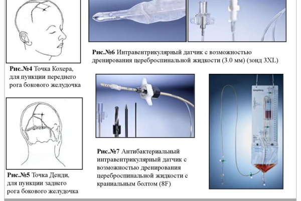 Оригинальная ссылка на кракен